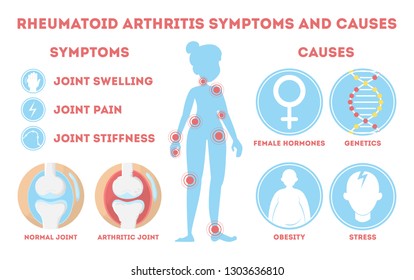 27,444 Rheumatic disease Images, Stock Photos & Vectors | Shutterstock