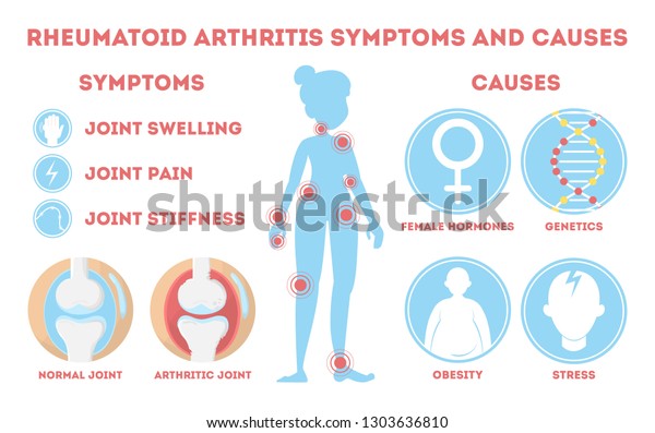 Rheumatism Infographic Bone Disease On Foot Stock Vector (Royalty Free ...