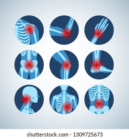 Rheumatism or rheumatic disorder medical set. Arthritis joint pain syndrome. Different body parts with pain rings on hand, leg and feet, spine, scull, pelvis. Rheumatology vector infographics elements