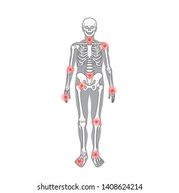 Rheumatism or rheumatic disorder medical set. Arthritis joint pain syndrome. Different body parts with pain rings joint pain on hand, leg and feet, spine. Rheumatology vector infographics elements