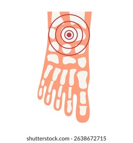 Rheumatoid arthritis ankle joint pain illustration. World Arthritis Day concept