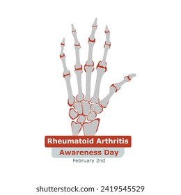 Rheumatoid Arthritis Awareness Day. Rheumatoid arthritis symptom on human joints and bones. Vector, illustration.