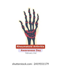 Rheumatoid Arthritis Awareness Day. Rheumatoid arthritis symptom on human joints and bones. Vector, illustration.