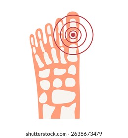 Rheumatoid arthritis finger toe joint pain illustration. World Arthritis Day concept