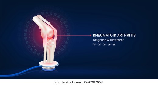 Rheumatoid arthritis, Human bone joint red cartilage model float away from stethoscope. Doctor diagnosis treatment. Medical technology innovation concept. Banner design for pharmacy clinic. 3d Vector.