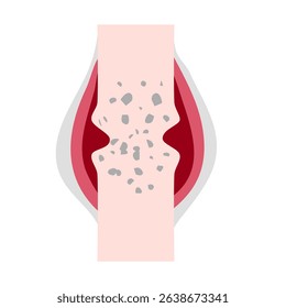 Rheumatoid arthritis illustration. World Arthritis Day concept
