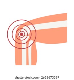 Rheumatoid arthritis knee pain illustration. World Arthritis Day concept