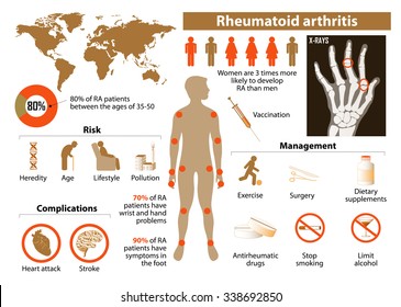 Rheumatoid arthritis. Medical Infographic set with icons and other elements