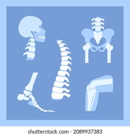 Rheumatoid Arthritis, Pain, Bone Disease Concept.Set With Neck Cervical Spine, Spine, Knee, Ankle And Other Joint Icons.Parts Of The Human Body, Anatomical Medical Poster.Xray Flat Vector Illustration