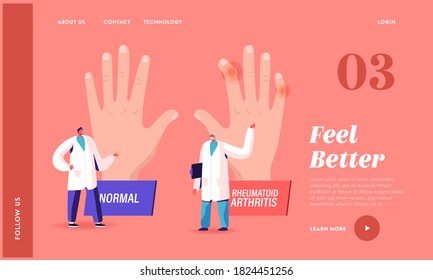 Rheumatoid Arthritis Sickness Landing Page Template. Doctor Arthrologist Pointing on Huge Hand with Joints Disease to Colleague. Medical Concilium in Hospital. Cartoon People Vector Illustration