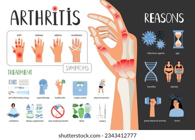 Rheumatoid arthritis vector medical poster. Symptoms treatment reasons of the disease. Medical infographic set with icons and other elements of poster rheumatology, vector illustration