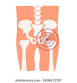 Rheumatoid arthritis waist joint paint illustration. World Arthritis Day concept
