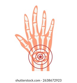 Rheumatoid arthritis wrist joint pain illustration. World Arthritis Day concept