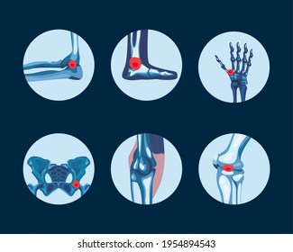 3,501 Arthrite Images, Stock Photos & Vectors 