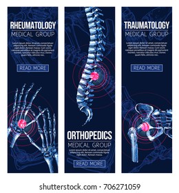 Rheumatology And Orthopedics Traumatology Medicine Banners. Vector Set Of Medical X-ray Of Human Body Bones And Joints For Leg Knee Or Foot, Spine And Arm Hand Trauma, And Wrist Arthritis