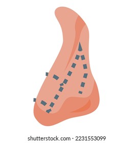 Rhinoplasty icon isometric vector. Nose surgery. Plastic open