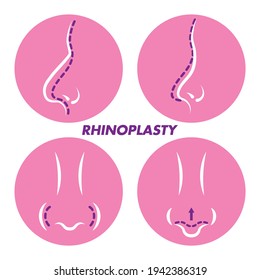 Rhinoplasty icons. Nose surgical correction icon. Nose job idea thin line illustration. Nose reshape. Breathing improve. Facial cosmetic surgery.  Plastic surgery nose. Before and after. Icon Set Veco