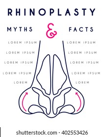 Rhinoplasty illustration. Moder vector style. Before and after.