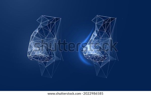 Rhinoplasty, nose surgery in a futuristic polygonal
style. Vector illustration demonstrates changes in the shape of the
nose after plastic surgery. Concept aesthetic medicine result
before and after