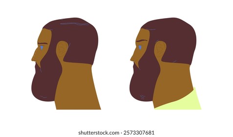 Rhinoplasty, plastic surgery before and after. Man patient profile, nose reshaping and cosmetic aesthetic enhancement, modification, correction. Flat vector illustration isolated on white background
