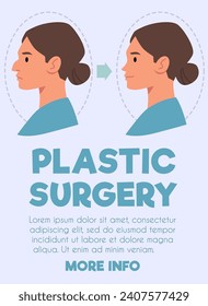 Rhinoplasty web banner for landing page. Woman profile before and after nose plastic surgery. Flat vector illustration design template.