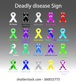 Ribbon sign for cancer