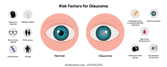 Risk factors for glaucoma disease Optometry