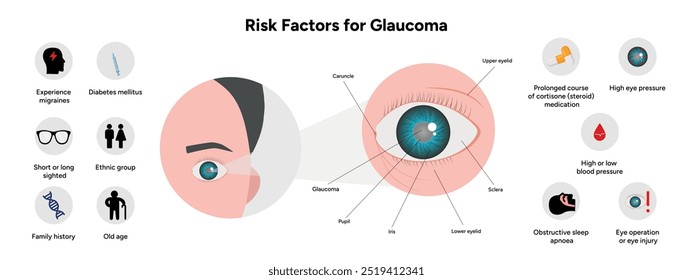 Risk factors for glaucoma disease Optometry