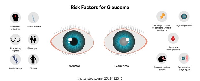 Risikofaktoren für die Glaukomerkrankung Optometrie