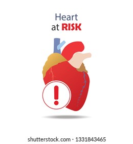 Risky heart attack alert symbol. heart care cardiology for health attention. Flat design for banner or poster. Vector illustration.