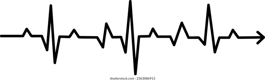 ritmo de latido vectorial ekg