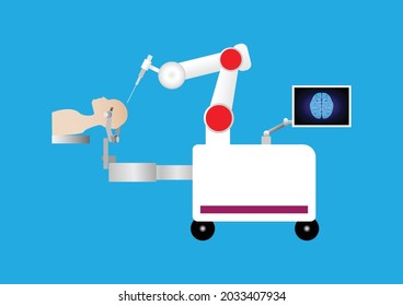 Robotic Assisted For Brain Surgery. Minimally Invasive In Neurosurgery. Robot With Arm And Computer Display.