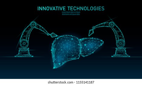 Robotic liver surgery low poly. Polygonal hepatitis surgery procedure. Robot arm manipulator. Modern innovative medicine science automation technology. Triangle 3D render shape vector illustration