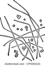 The rodlets after three hours' culture in a drop of aqueous humour. They grow out into long leptothrix-like filaments, which become septate later, and spores are developed in the segment, vintage