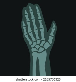 Roentgenogram of hand, isolated scan of limb, palm with fingers and joints. Medical care and healthcare in clinics or hospital, examination and science diseases treatment. Vector in flat style