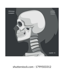Roentgenograph of Skull Side View Vector Image