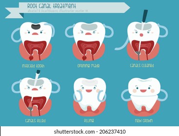 Root Canal Treatment 