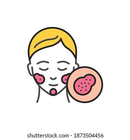 Rosacea disease line color icon. Sign for web page, mobile app