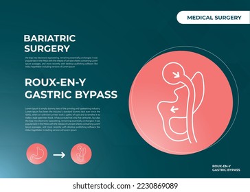 Roux-en-Y Gastric Bypass (RNY) Weight Loss Surgery vector illustration icon