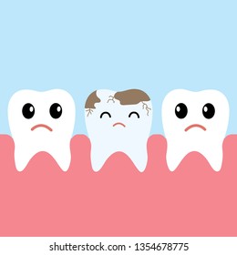Row of health teeth and one bad tooth with caries,healthcare concept,place for text,flat vector illustration