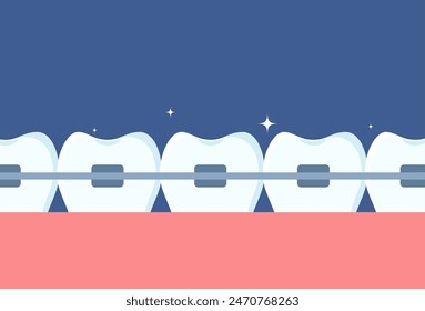 Row of teeth with braces on them. Orthodontics and aesthetic dentistry medicine. Molars with braces. Dentistry, whitening, orthodontics. Vector