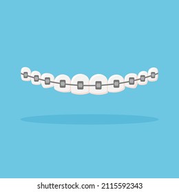 Row of teeth with braces. Orthodontic dentistry concept. Alignment of teeth. Dental care. Vector illustration isolated on blue background.