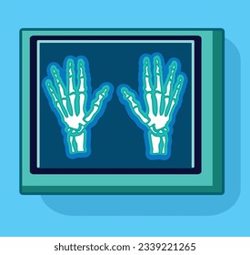 rtg hand picture injury screening doctor broken bone health xray picture rtg hospital vector illustration roentgen