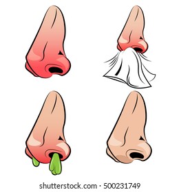 Runny nose set with stages of illness from healthy condition till disease isolated vector illustration