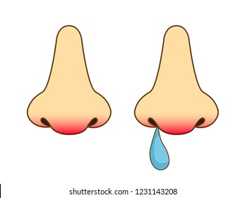 Runny Nose Vector