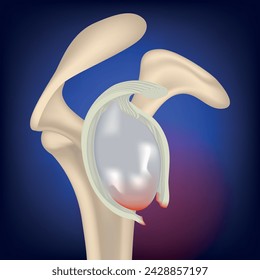 rupture of the clavicular cavity. Rendering of a collarbone on a blue neon background. Medical banner. Vector illustration