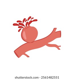 Ruptured Aneurysm, Cardiovascular Disease Illustration Icon