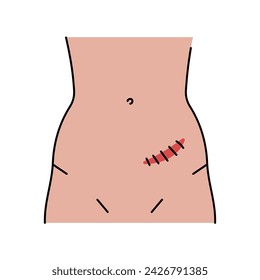 Rutherford morrison incision line icon. Abdominal incisions. Vector isolated element. Editable stroke.