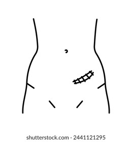 Rutherford morrison incision line icon. Abdominal incisions. Vector isolated element. Editable stroke.