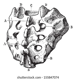Sacrum seen by its posterior surface, vintage engraved illustration. Usual Medicine Dictionary by Dr Labarthe - 1885.
